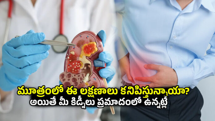 Kidney Disease